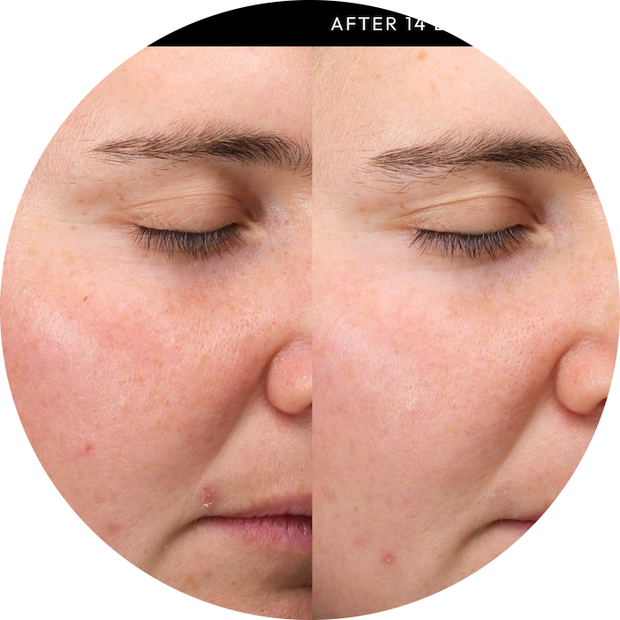 Exosome Hydro-Glow Complex Serum