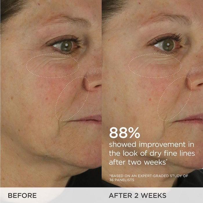 The Dewy Skin Cream