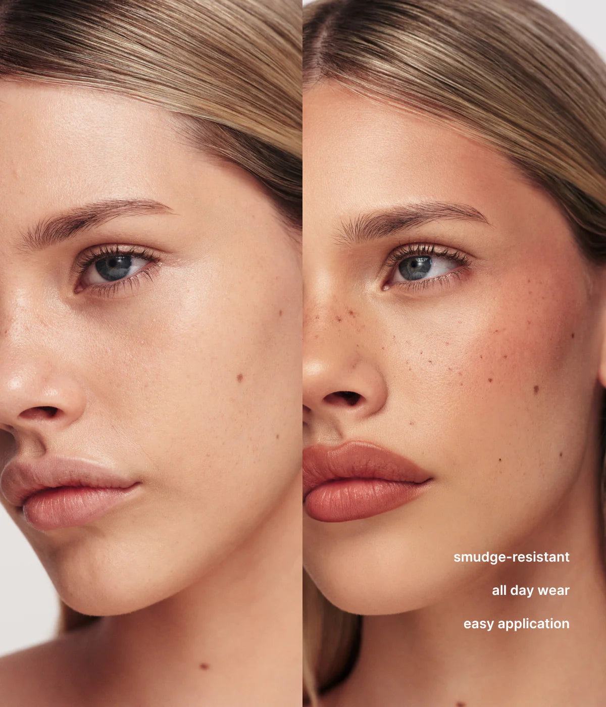 FRECKLE