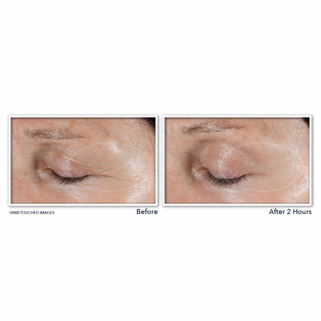 Retinol Correxion Deep Wrinkle Targeted Patches