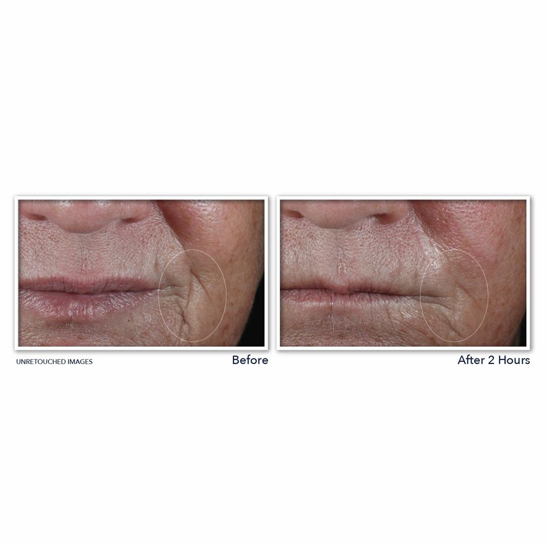 Retinol Correxion Deep Wrinkle Targeted Patches