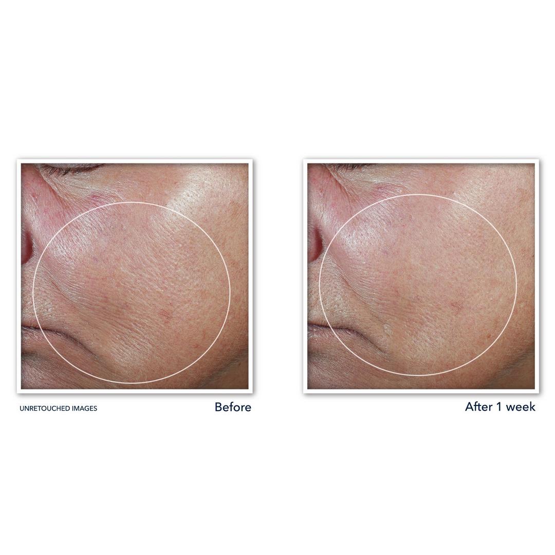 Derm Correxion Firming Serum Stick
