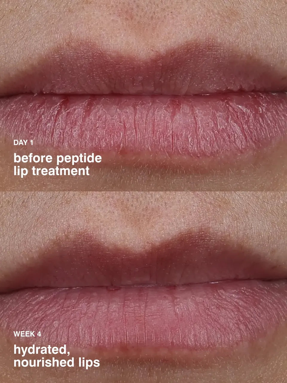 peptide lip treatment