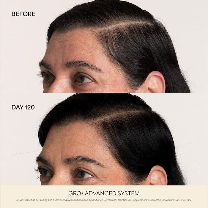 0.25 mm GRO+ Advanced Scalp Dermaroller