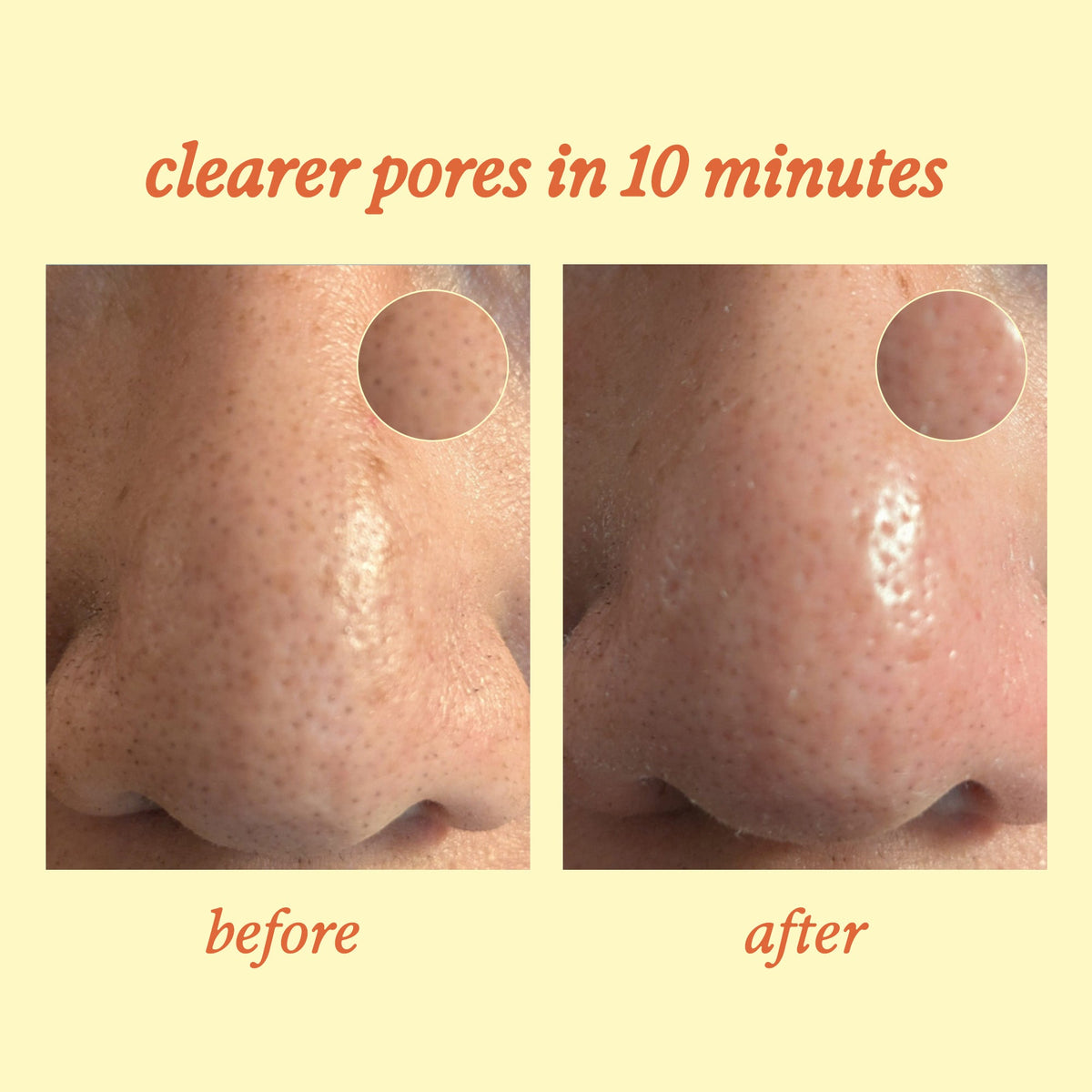 Unplug Blackhead-Melting Nose Strips NudeFace Chile