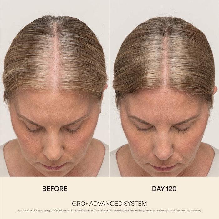 0.25 mm GRO+ Advanced Scalp Dermaroller