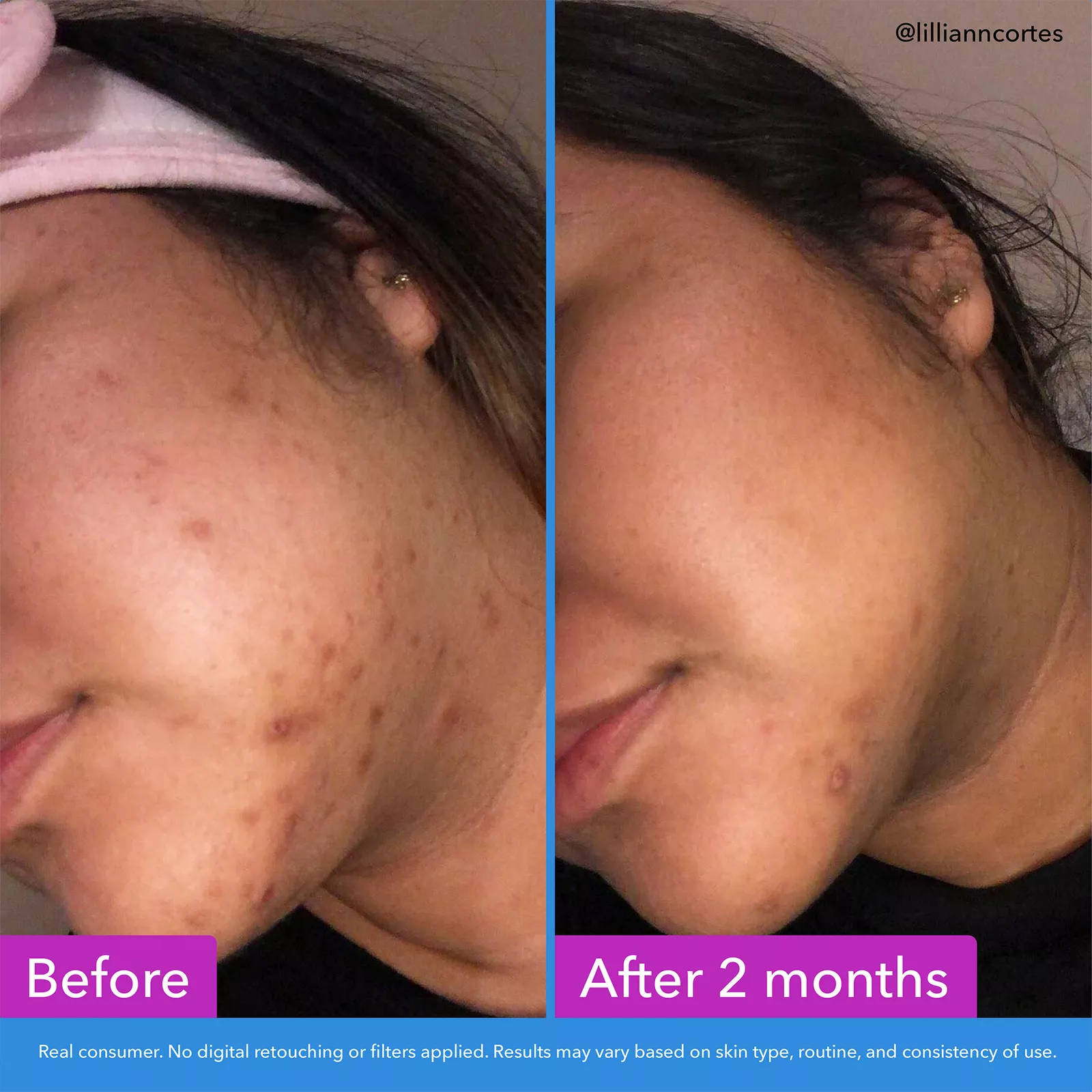 Discoloration Correcting Serum