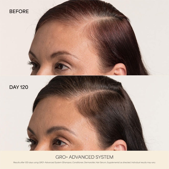 0.25 mm GRO+ Advanced Scalp Dermaroller