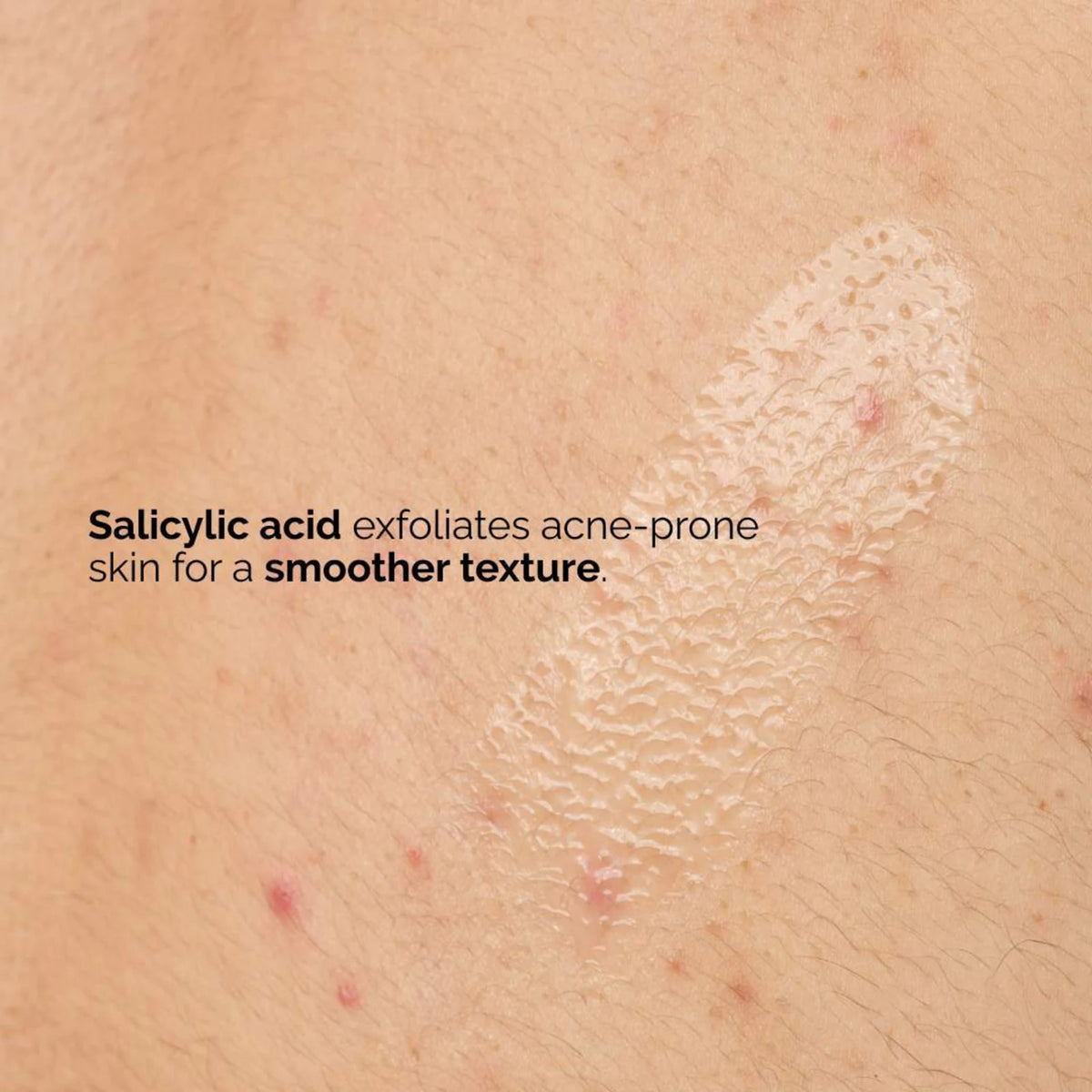 The Ordinary Salicylic Acid 0.5% Body Serum NudeFace Chile