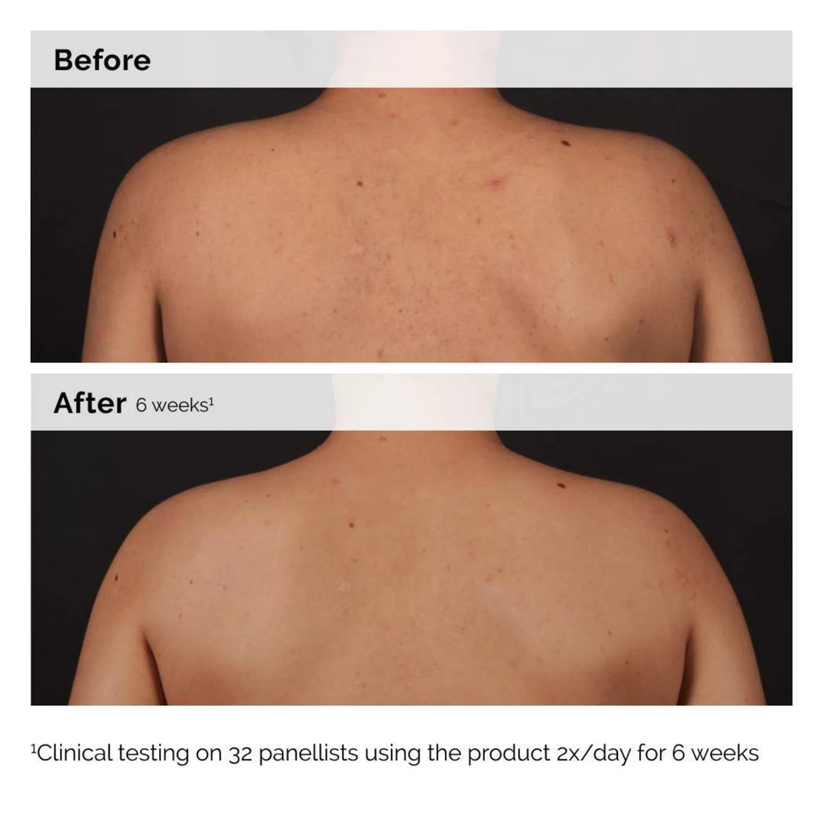 The Ordinary Salicylic Acid 0.5% Body Serum NudeFace Chile