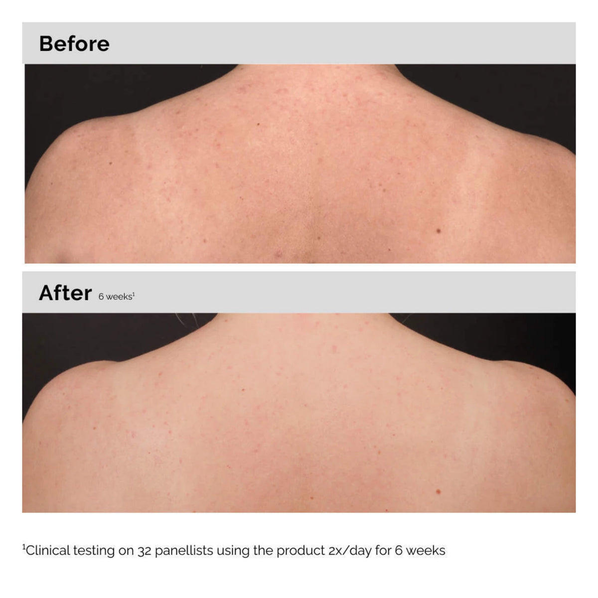 The Ordinary Salicylic Acid 0.5% Body Serum NudeFace Chile
