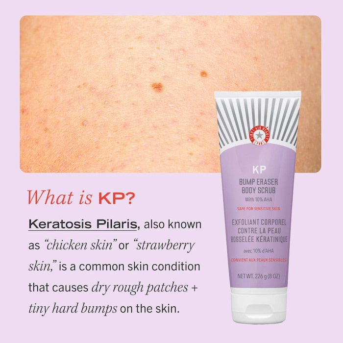 KP Bump Eraser Body Scrub