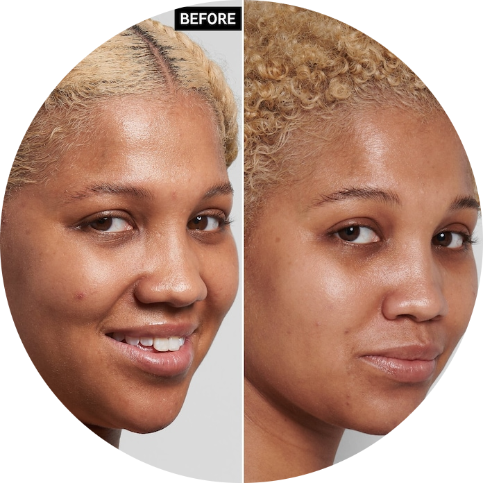 Niacinamide Oil Control Serum