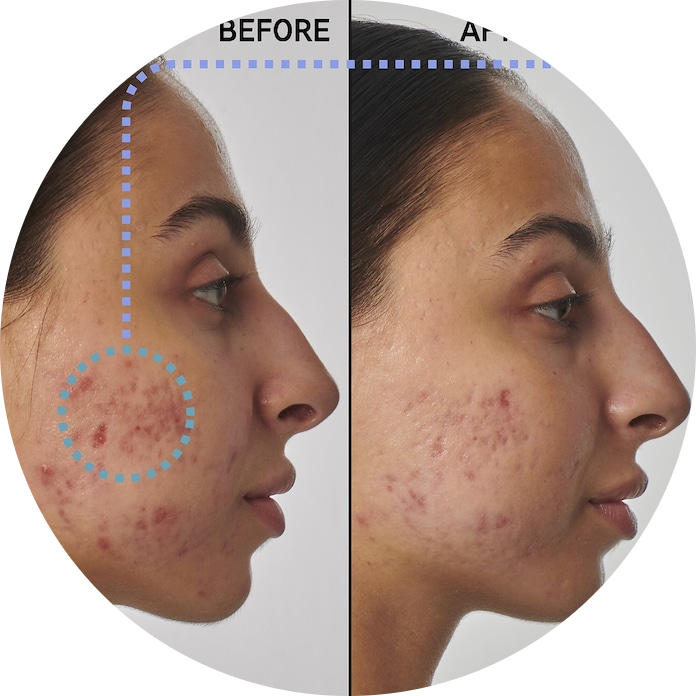 SuperSolutions 1% Retinol Serum