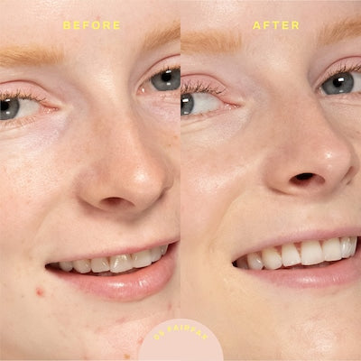SunnyDays SPF 30 Tinted Sunscreen Foundation
