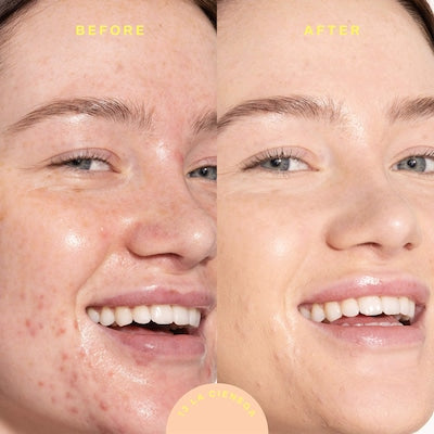 SunnyDays SPF 30 Tinted Sunscreen Foundation