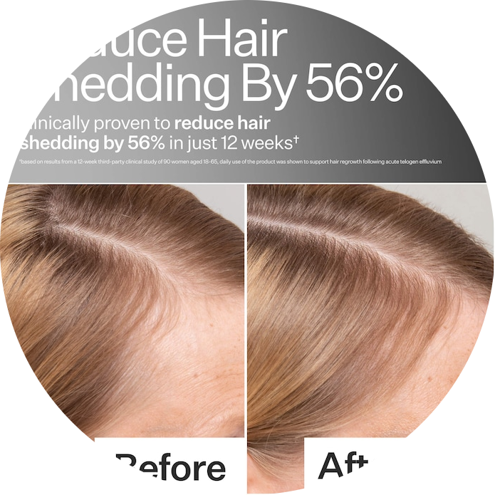 2% Stem Cell H-2 Grow Complex ™ Scalp Serum For Thicker-Looking Hair
