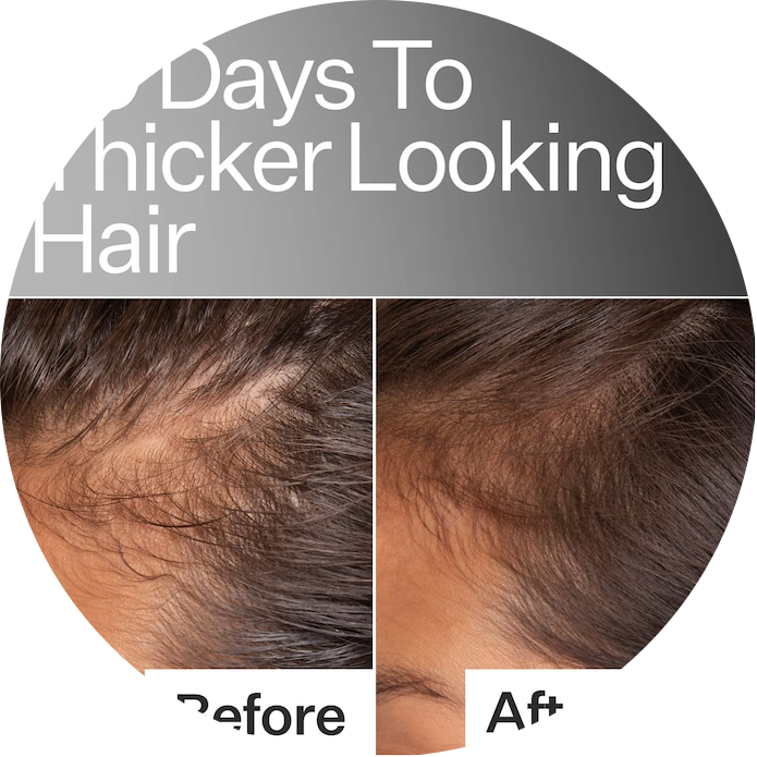 2% Stem Cell H-2 Grow Complex ™ Scalp Serum For Thicker-Looking Hair