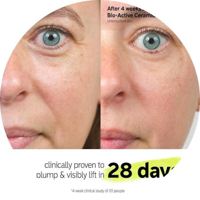 Bio-Active Ceramide Repairing and Plumping Moisturizer + Barrier Strengthening