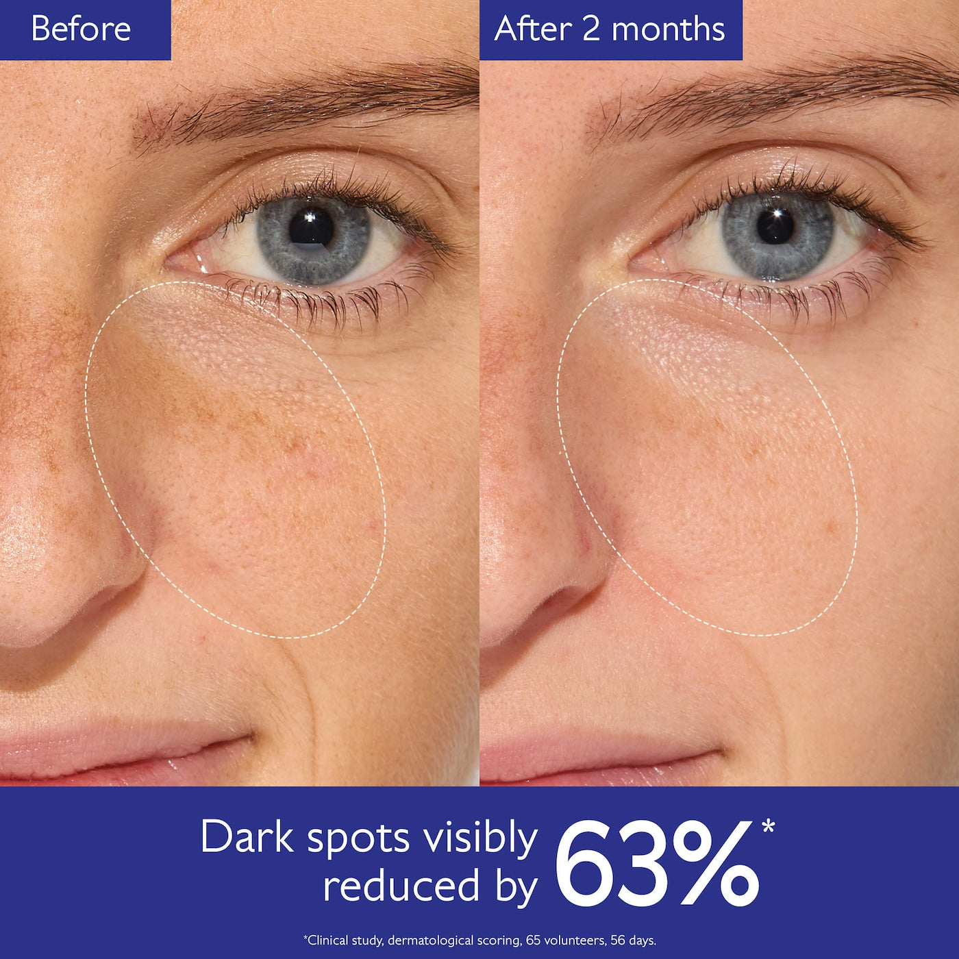 Vinoperfect Brightening Dark Spot Serum