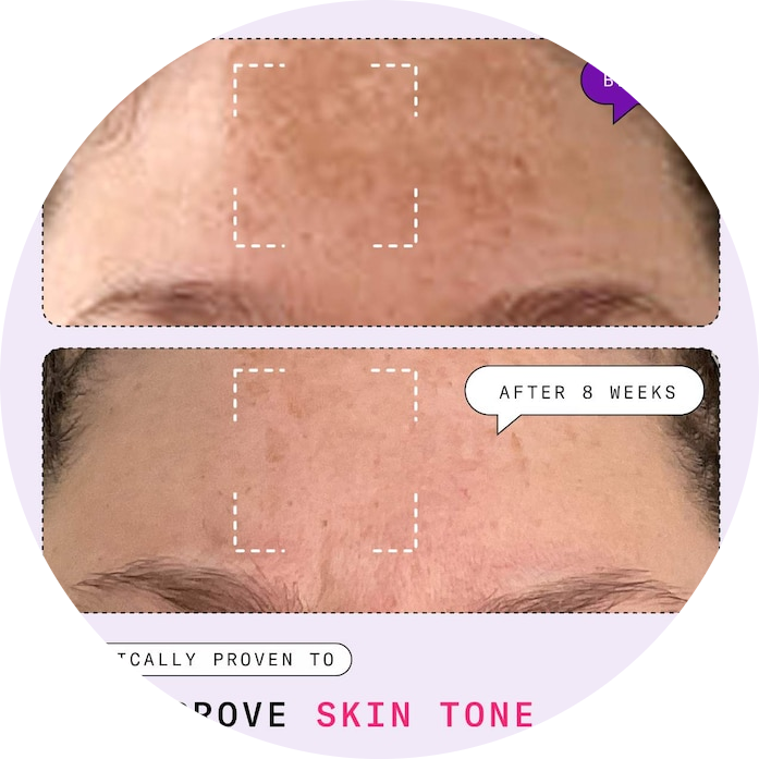 Major Fade Dark Spot Starter Kit