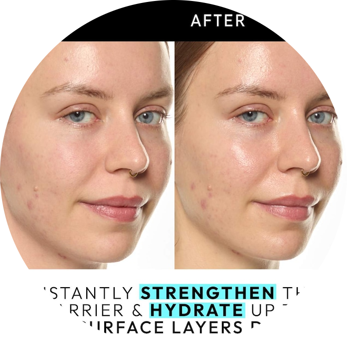 Ectoin Hydro-Barrier Serum