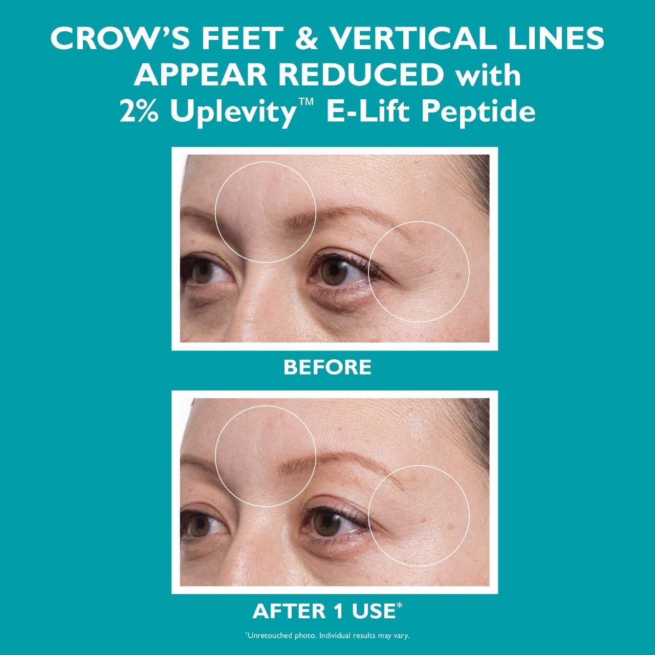 Peptide Skinjection Hydra-Gel Patches