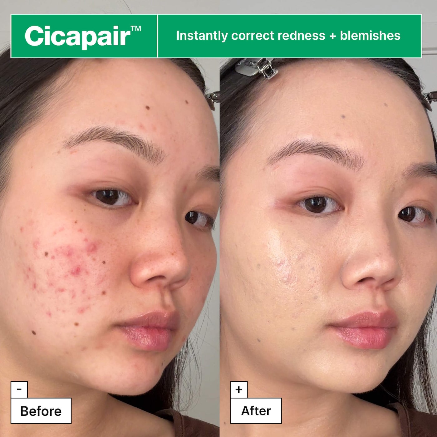 Cicapair™ Soothing Color Correcting Treatment