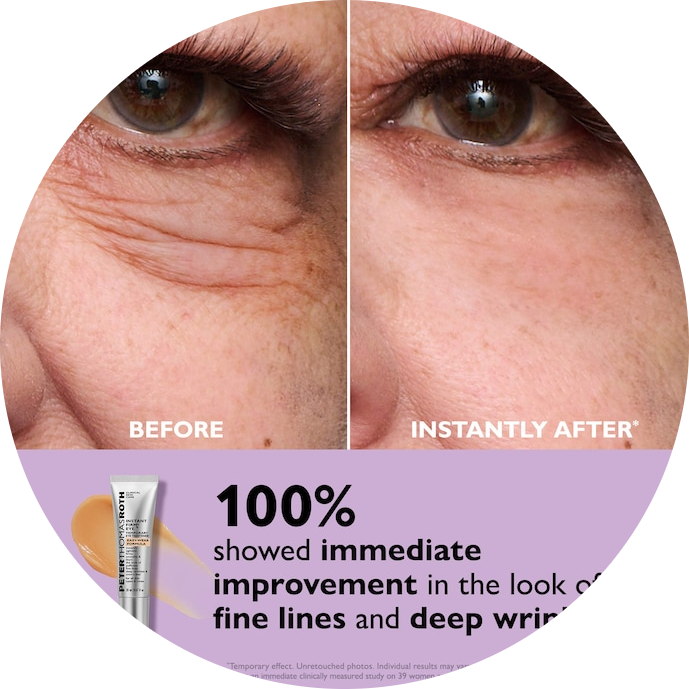 Instant FIRMx® Eye Temporary Eye Tightener