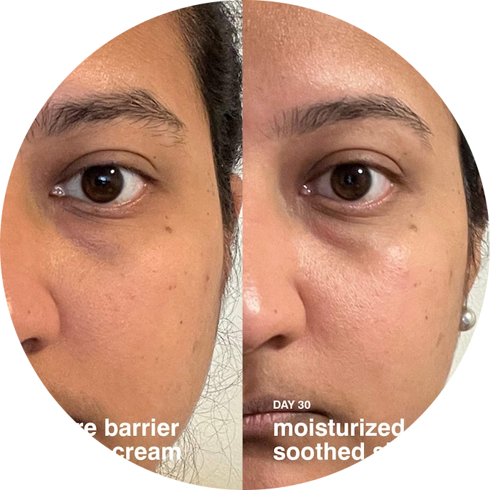 Mini Barrier Restore Cream Comforting Daily Moisturizer