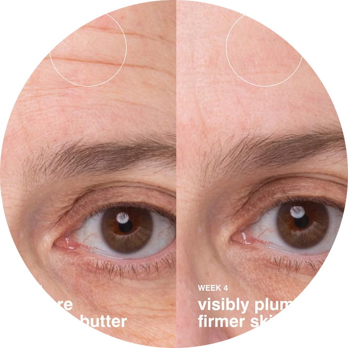 Mini Barrier Butter Intensive Moisture Balm