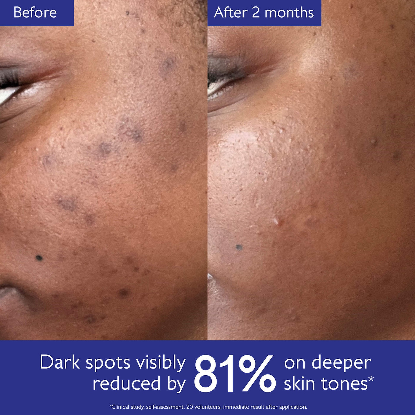Vinoperfect Brightening Dark Spot Serum