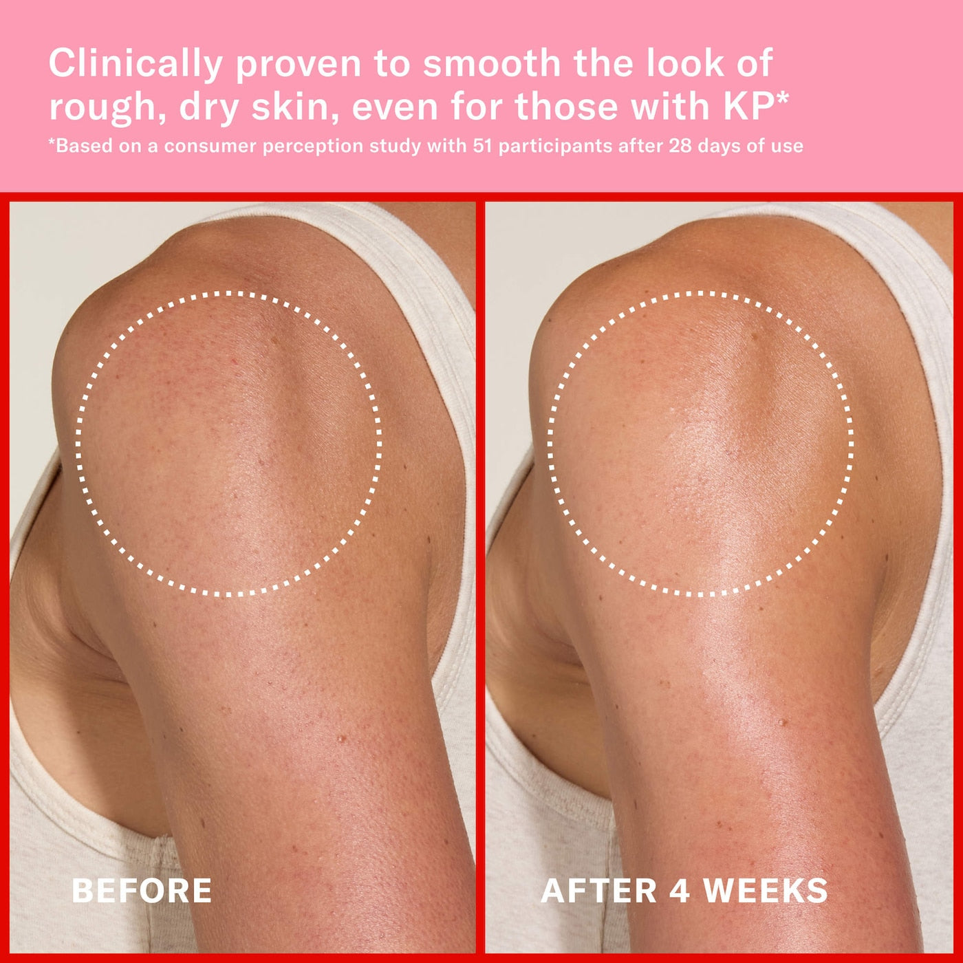 Pink Algae Pro-Retinol Body Butter NudeFace Chile