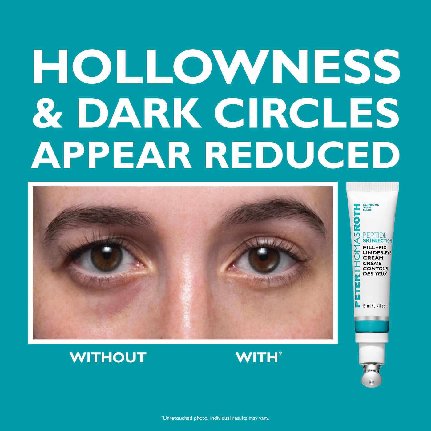 Peptide Skinjection™ Set