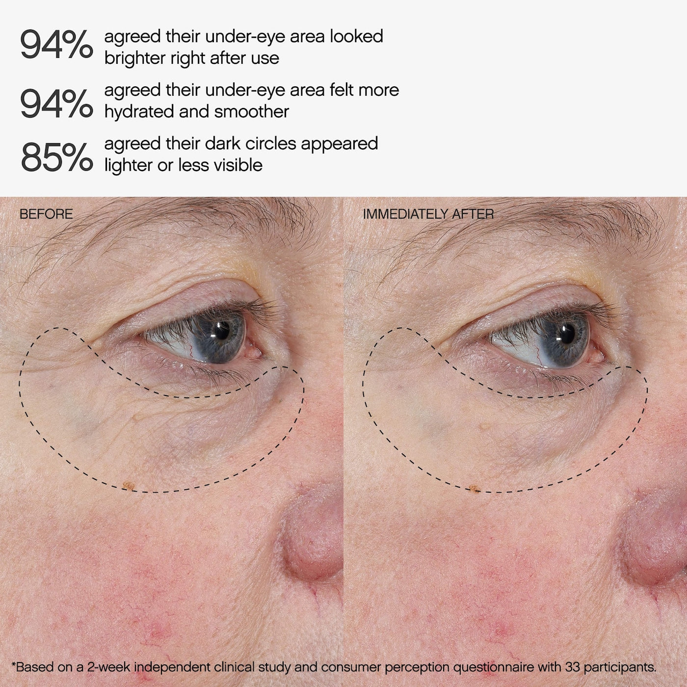 Faded Under Eye Brightening & Clearing Eye Masks NudeFace Chile
