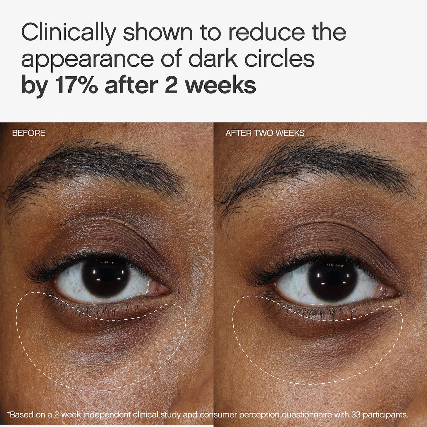 Faded Under Eye Brightening & Clearing Eye Masks NudeFace Chile